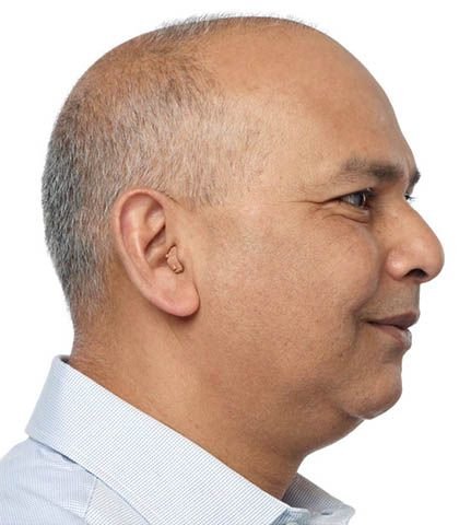 Invisible-In-the-Canal (IIC) Hearing Aids