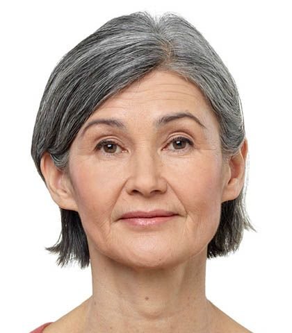 Completely-In-the-Canal (CIC) Hearing Aids